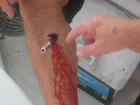 ouch-spearfishing-gone-wrong.jpg